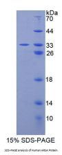 Human Arylsulfatase A (ARSA) Protein