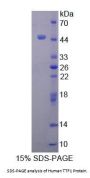 Human Transcription Termination Factor, RNA polymerase I (TTF1) Protein