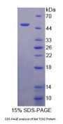 Rat Transcobalamin II, Macrocytic Anemia (TCN2) Protein