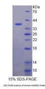 Human Ankyrin Repeat Domain Protein 1 (ANKRD1) Protein