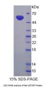 Rat UDP-Glucuronosyltransferase 2B7 (UGT2B7) Protein