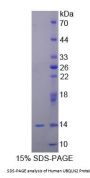 Human Ubiquilin 2 (UBQLN2) Protein
