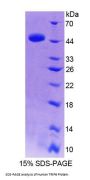 Human Thyroid Hormone Receptor Interactor 6 (TRIP6) Protein