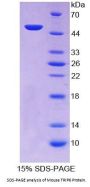 Mouse Thyroid Hormone Receptor Interactor 6 (TRIP6) Protein