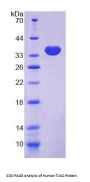 Human Talin 2 (TLN2) Protein