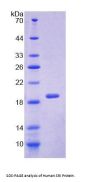 Human Sorcin (SRI) Protein