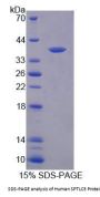 Human Serine Palmitoyltransferase, Long Chain Base Subunit 3 (SPTLC3) Protein