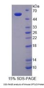 Mouse Serine Palmitoyltransferase, Long Chain Base Subunit 3 (SPTLC3) Protein