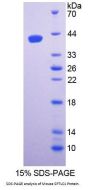 Mouse Serine Palmitoyltransferase, Long Chain Base Subunit 1 (SPTLC1) Protein