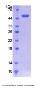Human Serine Peptidase Inhibitor Kunitz Type 2 (SPINT2) Protein