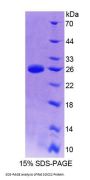 Rat Suppressors Of Cytokine Signaling 2 (SOCS2) Protein