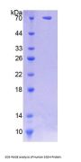 Human N-Sulfoglucosamine Sulfohydrolase (SGSH) Protein