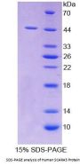 Human Scavenger Receptor Class A Member 5 (SCARA5) Protein