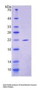 Human Suprabasin (SBSN) Protein