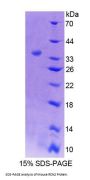 Mouse Reticulocalbin 2 (RCN2) Protein
