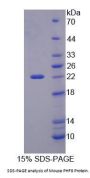 Mouse PHD Finger Protein 8 (PHF8) Protein