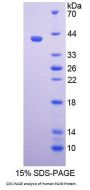 Human Paired Box Gene 9 (PAX9) Protein