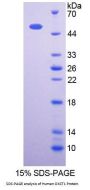 Human 3-Oxoacid Coenzyme A Transferase 1 (OXCT1) Protein