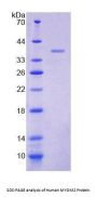 Human Myomesin 2 (MYOM2) Protein