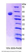 Mouse Mitochondrial Methionyl tRNA Formyltransferase (MTFMT) Protein