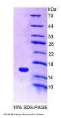 Mouse Melanoma-Derived Growth Regulatory Protein (MIA) Protein