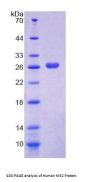 Human Malic Enzyme 2, NADP+ Dependent, Mitochondrial (ME2) Protein