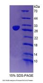 Mouse Elastin Microfibril Interface Located Protein 2 (EMILIN2) Protein