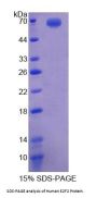 Human E2F Transcription Factor 2 (E2F2) Protein