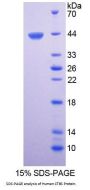 Human Di-N-Acetyl Chitobiase (CTBS) Protein
