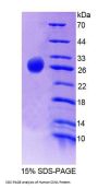 Human Alpha-S1-Casein (CSN1S1) Protein