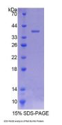 Rat Biliverdin Reductase A (BLVRA) Protein