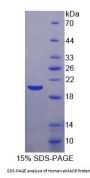 Human Alpha-Methylacyl Coenzyme A Racemase (aMACR) Protein