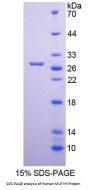 Human MutY Homolog (MUTYH) Protein