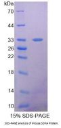 Mouse Succinate Dehydrogenase Complex Subunit A (SDHA) Protein