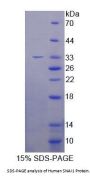 Human Snail Family Transcriptional Repressor 1 / SNAIL (SNAI1) Protein