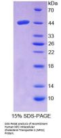 Human NPC Intracellular Cholesterol Transporter 2 (NPC2) Protein