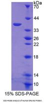 Human Endoplasmic Reticulum Lipid Raft Associated Protein 2 (ERLIN2) Protein
