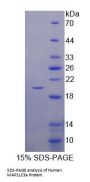 Human Microtubule Associated Protein 1 Light Chain 3 Alpha (MAP1LC3a) Protein