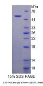 Human Secreted And Transmembrane Protein 1 (SECTM1) Protein