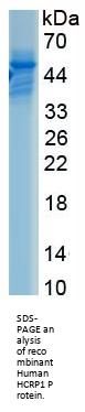 Human Hepatocellular Carcinoma Related Protein 1 (HCRP1) Protein