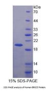 Human Lys-63-Specific Deubiquitinase BRCC36 (BRCC3) Protein