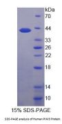 Human Pim-3 Oncogene (PIM3) Protein