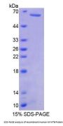 Human Myosin-7B (MYH7B) Protein