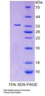 Human Translocase Of Outer Mitochondrial Membrane 70A (TOMM70A) Protein