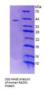 Human RAD51 Homolog (RAD51) Protein