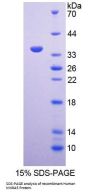 Human Matrix Remodelling Associated Protein 5 (MXRA5) Protein