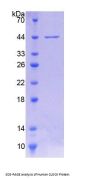 Human Clock Homolog (CLOCK) Protein