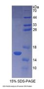 Human Coupling Factor 6 (CF6) Protein