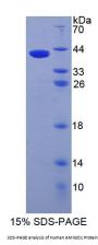 Human Adhesion Molecule With Ig Like Domain Protein 1 (AMIGO1) Protein