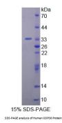 Human COP9 Constitutive Photomorphogenic Homolog Subunit 6 (COPS6) Protein